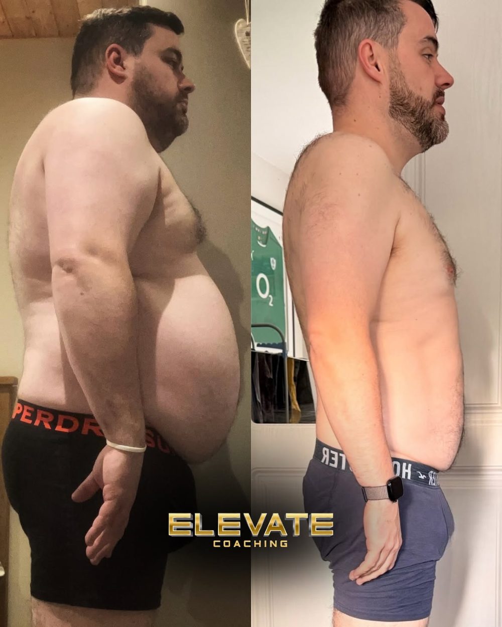 Client before and after transformation, front view